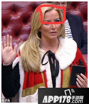 土豪脸长什么样子 男女土豪脸面部特征介绍7